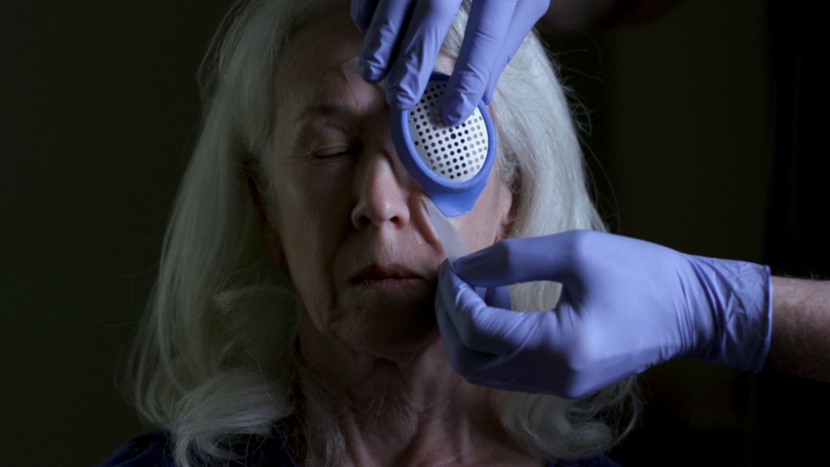 Cataract Business Insights