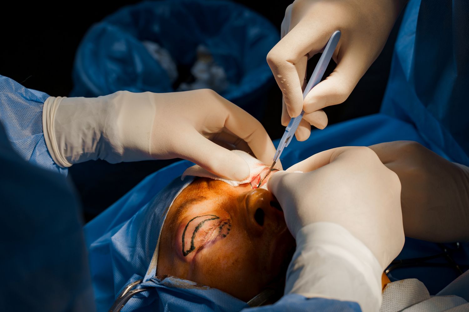 Oculoplastic Business Insights